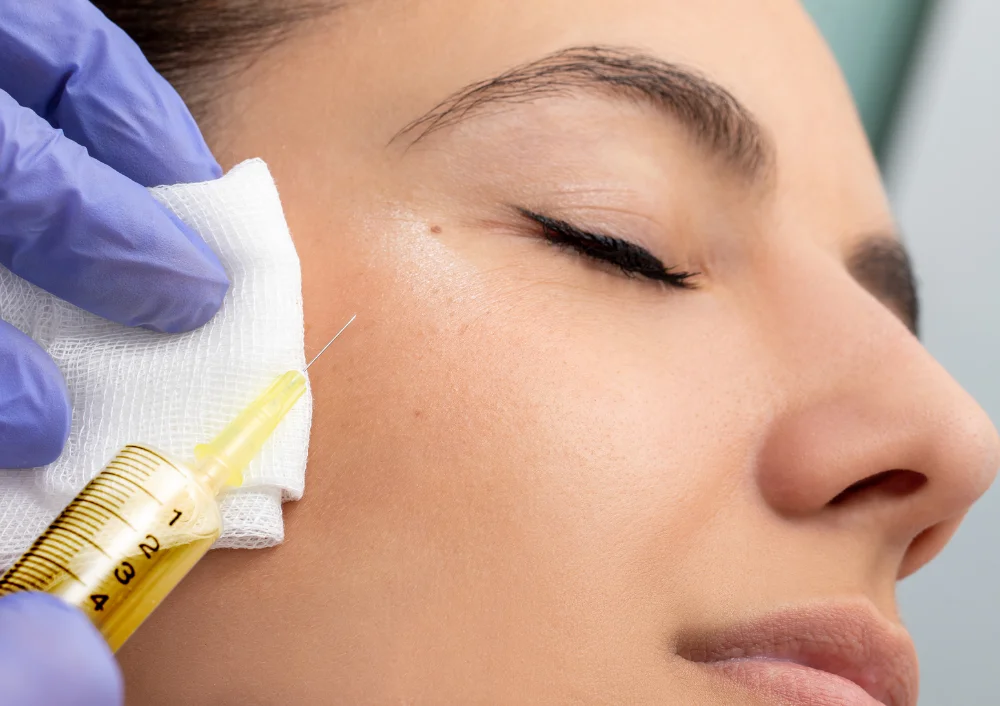 Mesotherapy